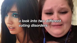 alr: a look into two different eating disorders