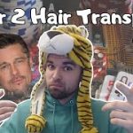 Poker to Hair Transplant | Ep. 2